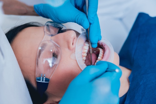 Preparing for Root Canal Treatment Endodontist in Buffalo, NY