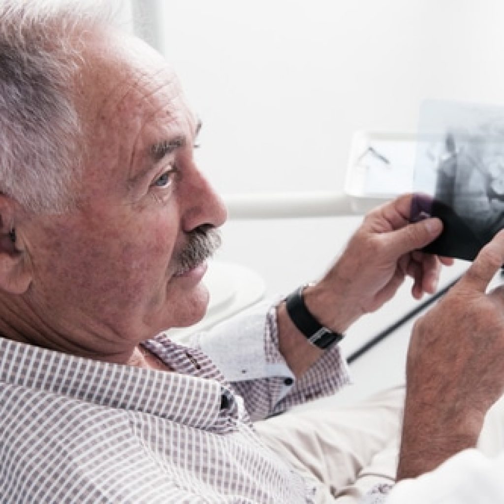 Basic Root Canal Information