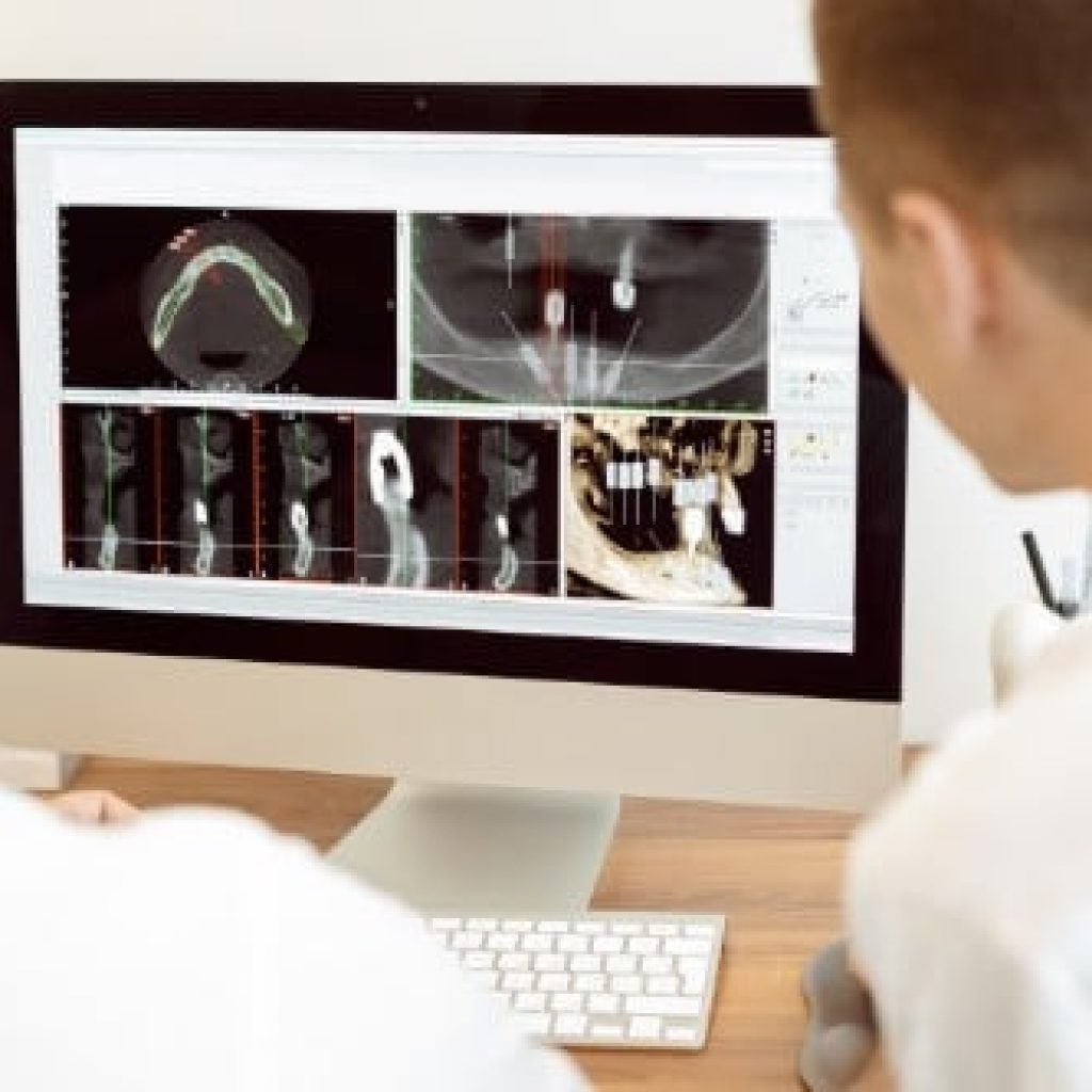 Preparing for root canal