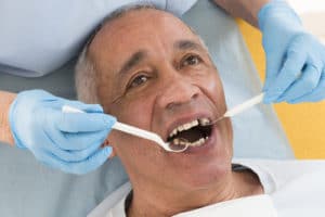 Dental Avulsion Explained | Buffalo Root Canal Dentist | Endodontist