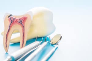 Apexification | Precision Endodontics | Vital Pulp Therapy